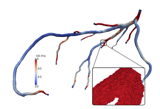 Hemodynamics Project Image